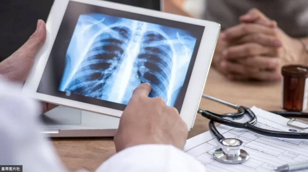 BBC:所谓的“健康电子烟”或许并不健康