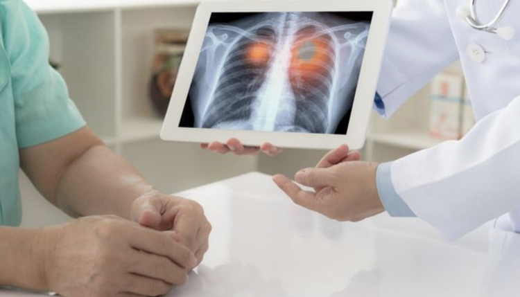 The Dangers of Vaping on Lung Health