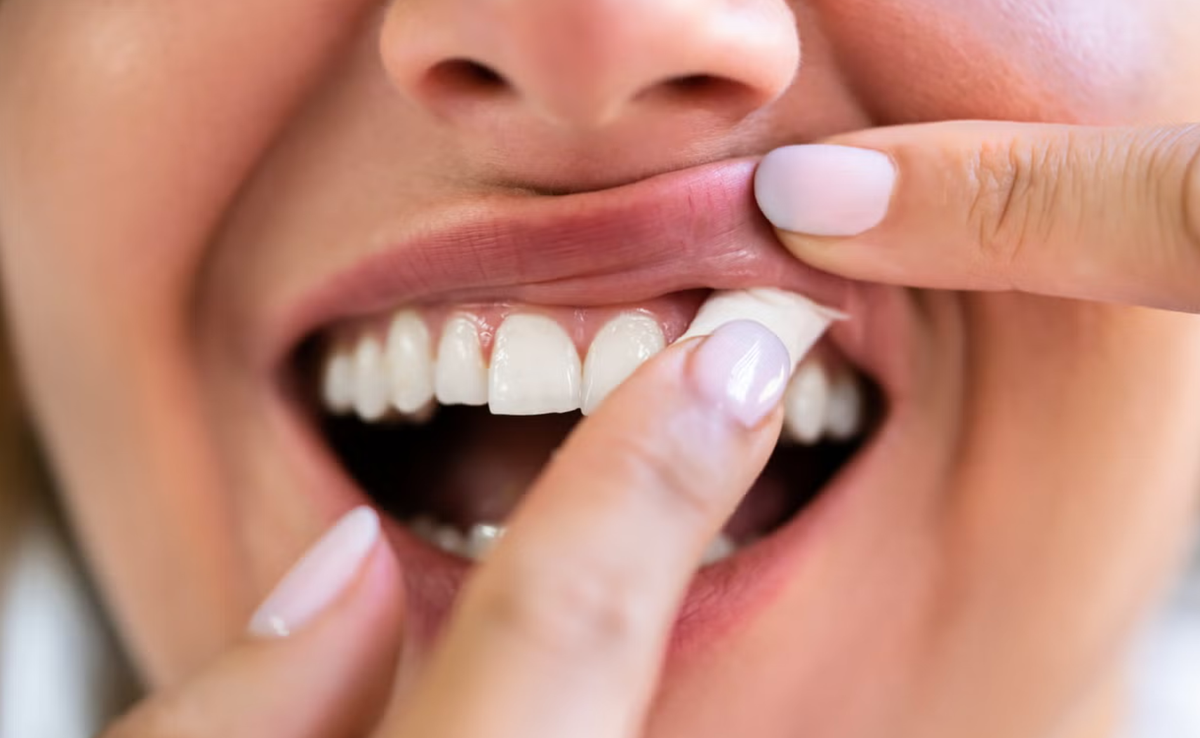 Scotland in the UK to Regulate Nicotine Pouches Under New Tobacco Control Measures