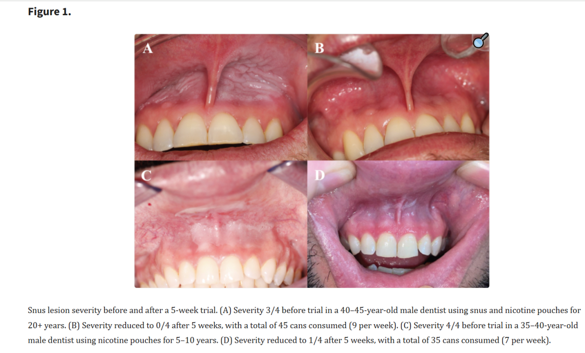 2Firsts Interview | Bengt Wiberg: Why the Oral Health Risks of Nicotine Pouches Merit Further Study
